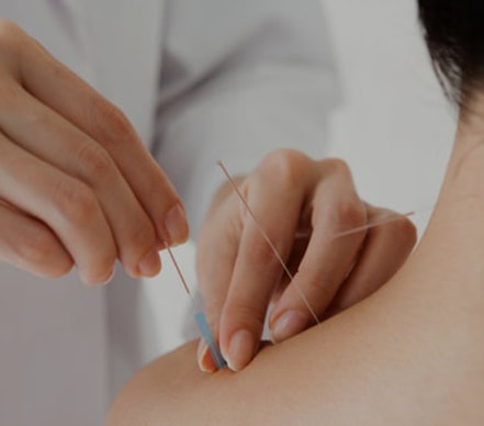 Needling shoulder, from an Acupuncturist